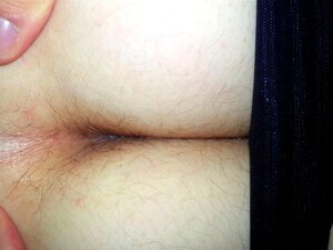 Juego Anal